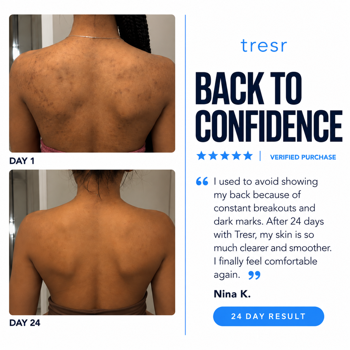TRESR™ Back & Chest Bar